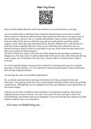 Skin Tag Essay
Keep yourself updated about the small skin extensions in your body known as skin tags.
Are you worried about a small flap of skin which has been growing on your neck or armpit?
These extensions of flesh are called skin tags. Many people are there who are not quite aware of
the term skin tags , however, this is a common phenomenon. Flaps of tissues which protrudes
from the surface of the skin are called skin tags and are usually present around the eyelids,
armpits or neck. These skin tags which hang off the skin have different sizes, with the help of a
stalk they remains attached to the skin. They are also called skin tabs or barnacles, they are
harmless having no direct ill effect on your health in any way. Most of the time they match your ...
Show more content on Helpwriting.net ...
The flow of blood into and out of the skin tag will be stopped by this procedure resulting it to
disappear in a few days. Since it is almost impossible for the person who suffers from anal skin tag
to get a proper view of this part of the skin, thus, a friend s help or a family member s help is
necessary.
It is to be noted that despite of using all these methods for removing rectal tags, be it cosmetic
procedure or home remedies, it is very important to maintain proper hygiene without which these
skin anal tags might get infected.
Are anal tags the cause of any health complications?
No, as already mentioned above anal tags are harmless, but if they get ruptured from anal
intercourse or by passing a hard stool, they can get infected which can further lead to lots of health
complications. Although they are not contagious but if they gets inflamed, or gets injured they can
take serious shapes.
Anal tags are not risky to health but causes problems in maintaining cleanliness. Skin tags by
trapping moistures causes irritation. You must visit a doctor for your anal tags in order to be
ensured that they are harmless and are not malignant. If your anal skin tags don t indicate any other
medical condition, they are not harmful in
... Get more on HelpWriting.net ...
 