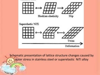 Schematic presentation of lattice structure changes caused by
outer stress in stainless steel or superelastic NiTi alloy
 
