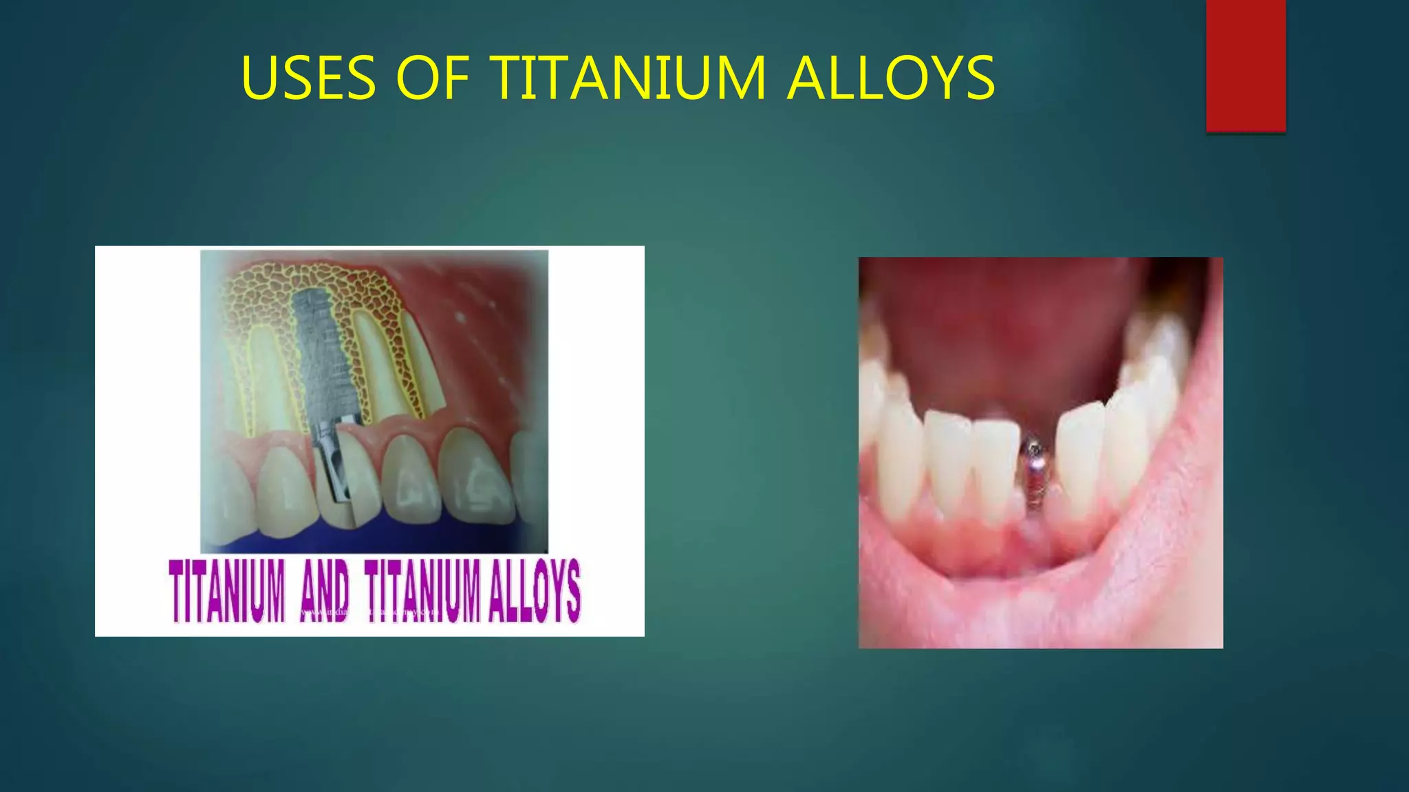 Wrought alloys in dentistry PPT