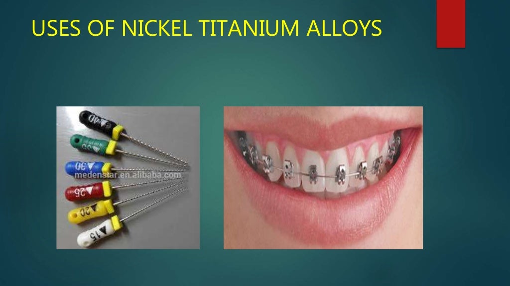 Wrought alloys in dentistry