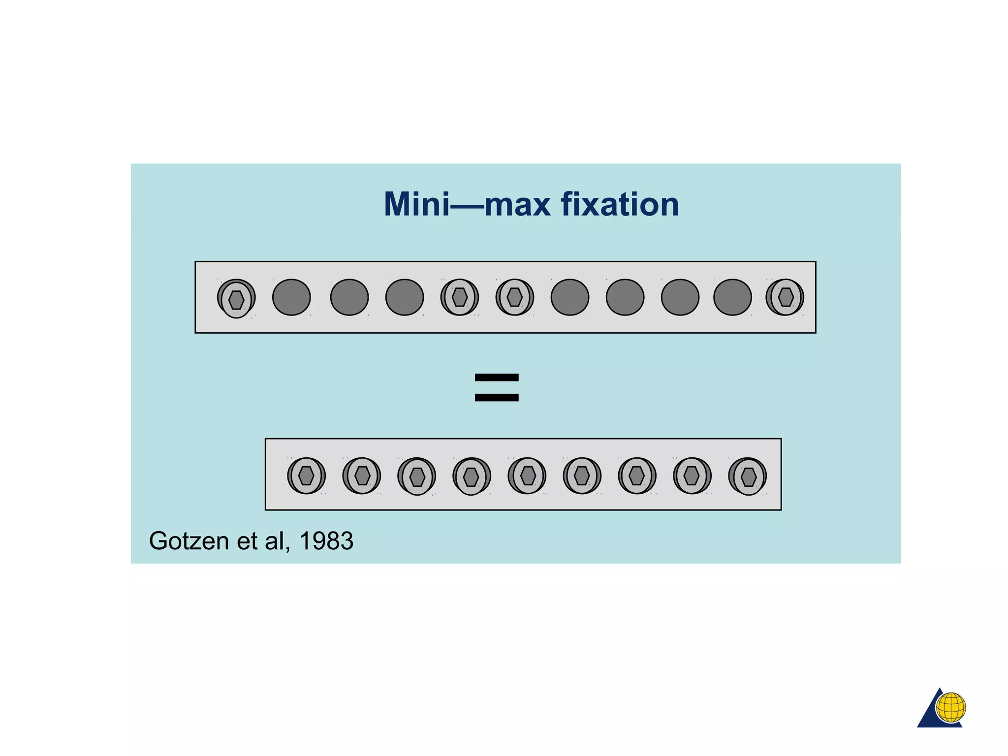 =
Gotzen et al, 1983
Mini—max fixation
 