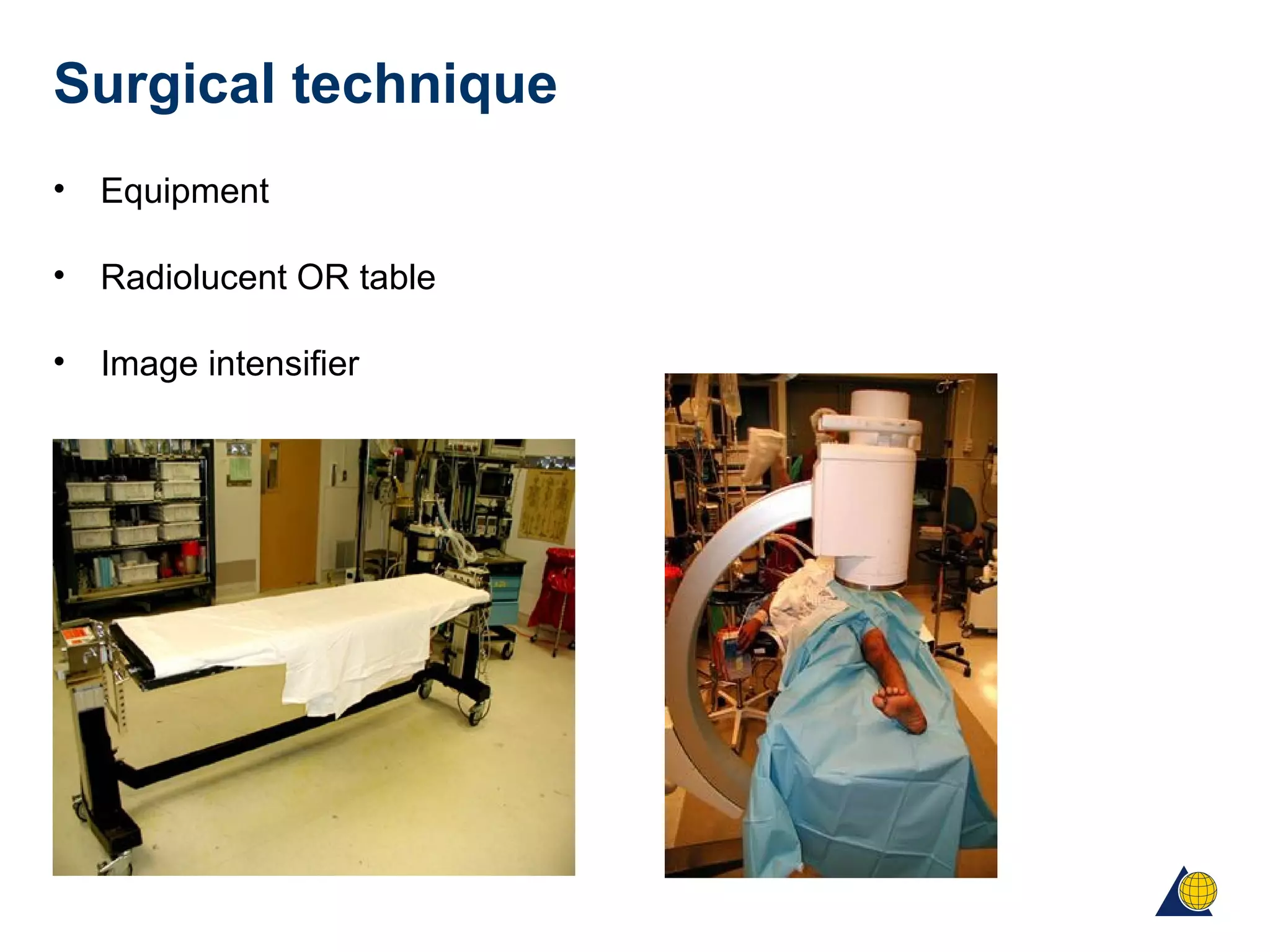 Surgical technique
• Equipment
• Radiolucent OR table
• Image intensifier
 