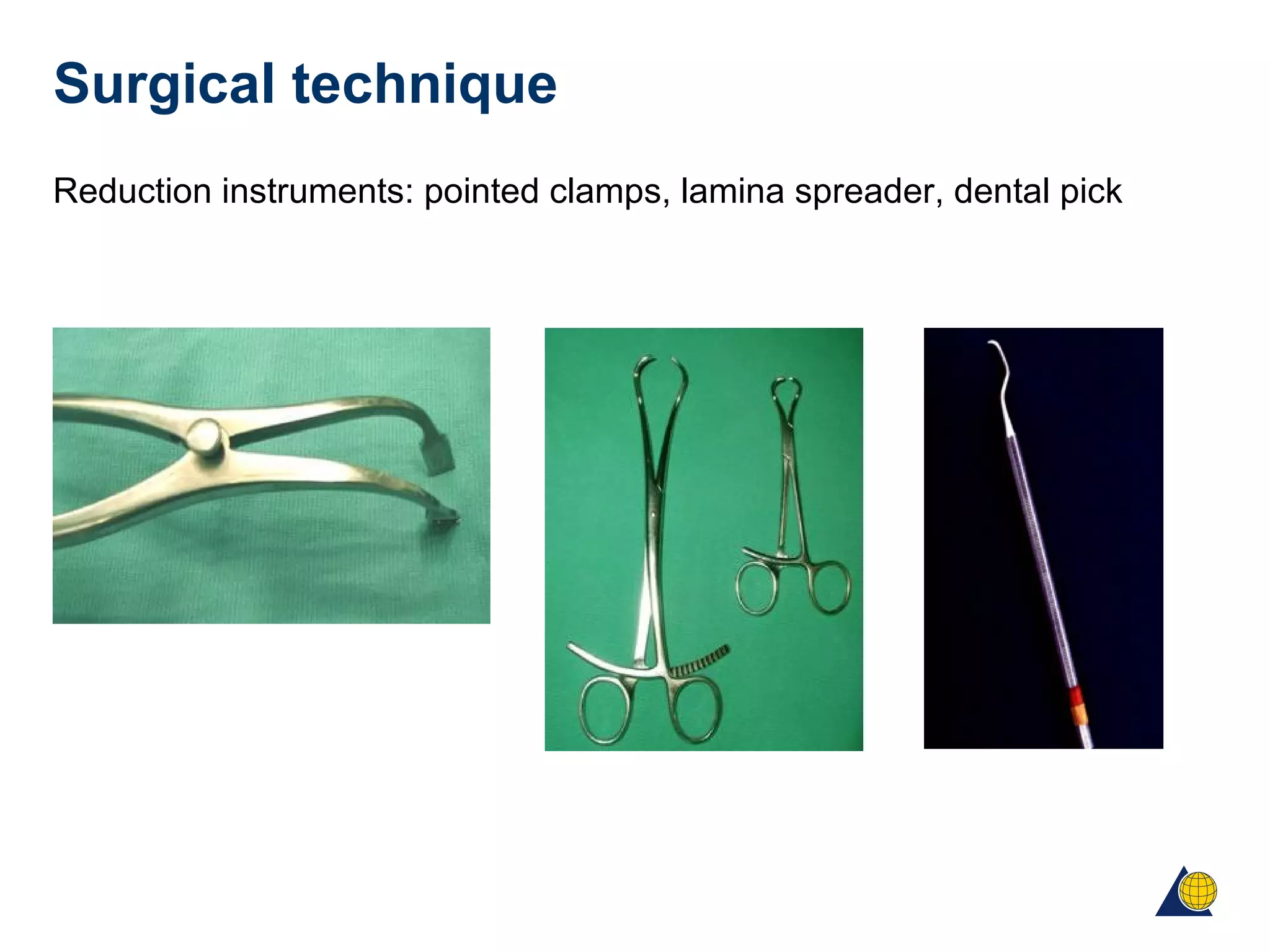 Surgical technique
Reduction instruments: pointed clamps, lamina spreader, dental pick
 