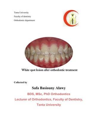 Tanta University
Faculty of dentistry
Orthodontic department
Collected by
Safa Basiouny Alawy
BDS, MSc, PhD Orthodontics
Lecturer of Orthodontics, Faculty of Dentistry,
Tanta University
White spot lesion after orthodontic treatment
 