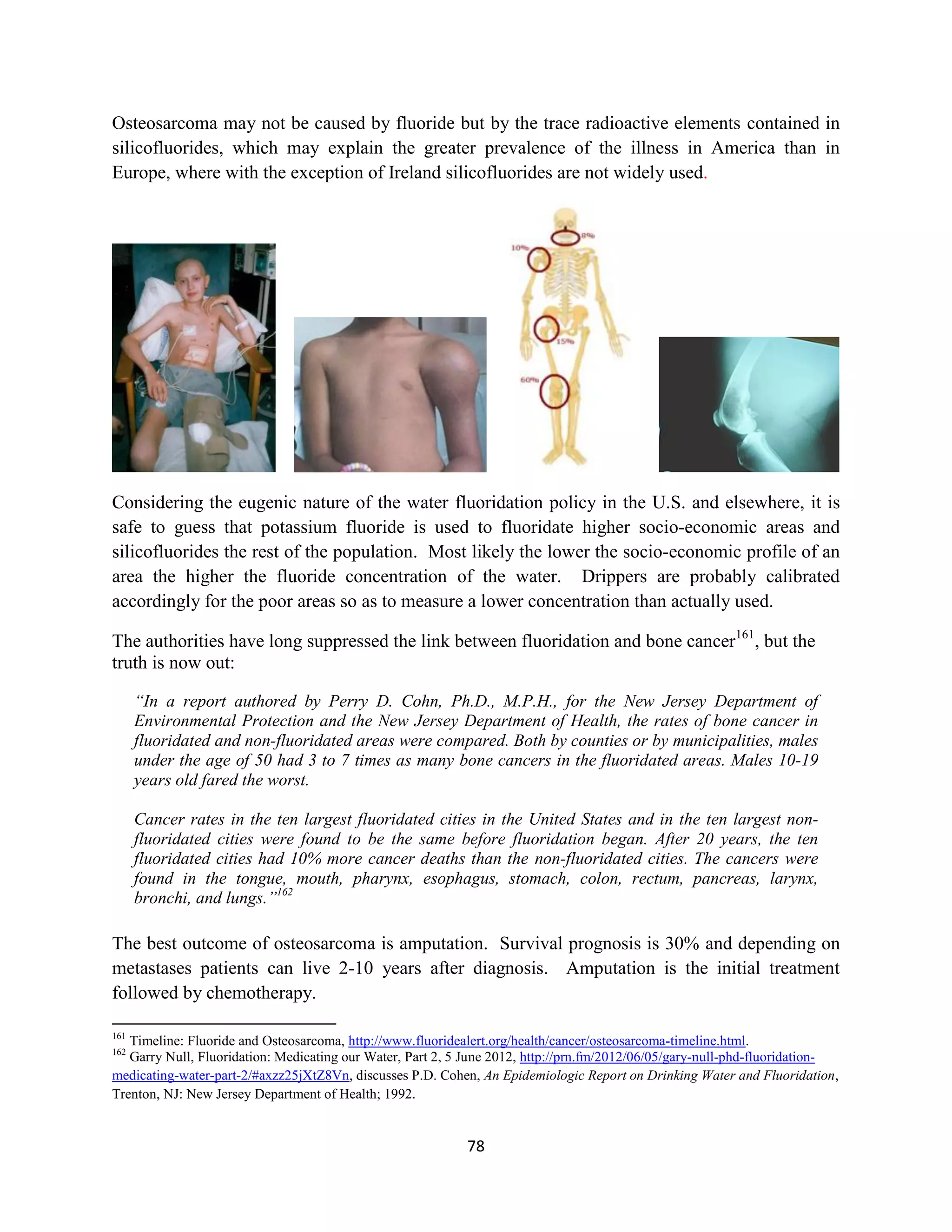 Osteosarcoma may not be caused by fluoride but by the trace radioactive elements contained in
silicofluorides, which may explain the greater prevalence of the illness in America than in
Europe, where with the exception of Ireland silicofluorides are not widely used.




Considering the eugenic nature of the water fluoridation policy in the U.S. and elsewhere, it is
safe to guess that potassium fluoride is used to fluoridate higher socio-economic areas and
silicofluorides the rest of the population. Most likely the lower the socio-economic profile of an
area the higher the fluoride concentration of the water. Drippers are probably calibrated
accordingly for the poor areas so as to measure a lower concentration than actually used.

The authorities have long suppressed the link between fluoridation and bone cancer161, but the
truth is now out:

      “In a report authored by Perry D. Cohn, Ph.D., M.P.H., for the New Jersey Department of
      Environmental Protection and the New Jersey Department of Health, the rates of bone cancer in
      fluoridated and non-fluoridated areas were compared. Both by counties or by municipalities, males
      under the age of 50 had 3 to 7 times as many bone cancers in the fluoridated areas. Males 10-19
      years old fared the worst.

      Cancer rates in the ten largest fluoridated cities in the United States and in the ten largest non-
      fluoridated cities were found to be the same before fluoridation began. After 20 years, the ten
      fluoridated cities had 10% more cancer deaths than the non-fluoridated cities. The cancers were
      found in the tongue, mouth, pharynx, esophagus, stomach, colon, rectum, pancreas, larynx,
      bronchi, and lungs.”162

The best outcome of osteosarcoma is amputation. Survival prognosis is 30% and depending on
metastases patients can live 2-10 years after diagnosis. Amputation is the initial treatment
followed by chemotherapy.

161
   Timeline: Fluoride and Osteosarcoma, http://www.fluoridealert.org/health/cancer/osteosarcoma-timeline.html.
162
   Garry Null, Fluoridation: Medicating our Water, Part 2, 5 June 2012, http://prn.fm/2012/06/05/gary-null-phd-fluoridation-
medicating-water-part-2/#axzz25jXtZ8Vn, discusses P.D. Cohen, An Epidemiologic Report on Drinking Water and Fluoridation,
Trenton, NJ: New Jersey Department of Health; 1992.


                                                            78
 