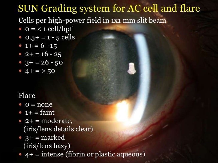 W smith uveitis compressed 5.22.11 (1)