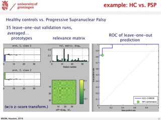 WSOM, Houston, 2016 13
Healthy controls vs. Progressive Supranuclear Palsy
35 leave-one-out validation runs,
averaged…
prototypes relevance matrix
example: HC vs. PSP
ROC of leave-one-out
prediction
(w/o z-score transform.)
 