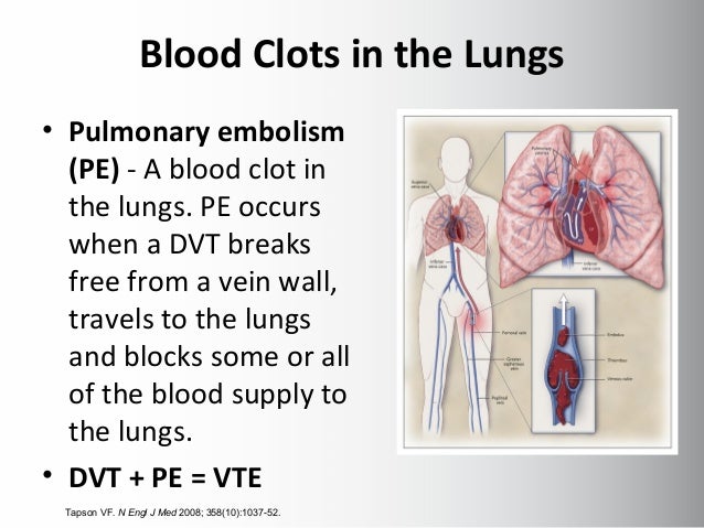 blood clot lungs cause blood clot lungs cause