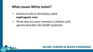 • Immature cells in the kidney called
nephrogenic rests
• These cells are more common in children with
genetic disorders like WAGR syndrome
What causes Wilms tumor?
WILMS TUMOR IN WAGR SYNDROME
 