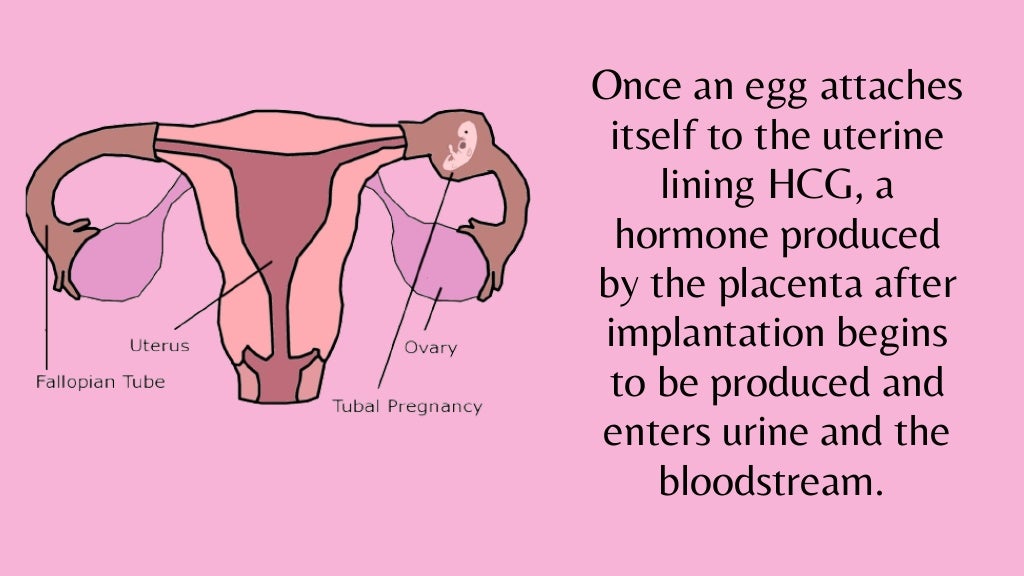 5 Ways You Can Have A False Negative Pregnancy Test