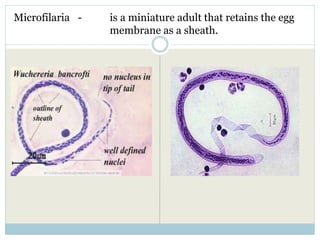Microfilaria - is a miniature adult that retains the egg
membrane as a sheath.
 