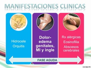 MANIFESTACIONES CLINICASFASE AGUDA