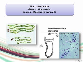 Filum: NematodaGénero: WuchereriaEspecie: WuchereriabancroftiFormas embrionarias o microfilarias 
