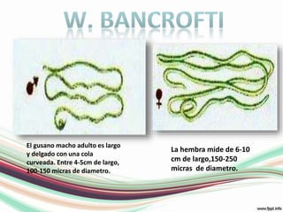 w. bancroftiEl gusano macho adulto es largo y delgado con una cola curveada. Entre 4-5cm de largo, 100-150 micras de diametro.La hembra mide de 6-10 cm de largo,150-250 micras  de diametro.