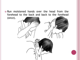    Run moistened hands over the head from the
    forehead to the back and back to the forehead
    (once).
 