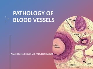PATHOLOGY OF
BLOOD VESSELS
Angel R Reyes Jr, RMT, MD, FPSP, CHA DipHLM
 