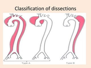 WUP Pathology of BLOOD VESSELS in philippines .pptx