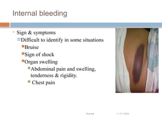 _bleeding_dressing.pptx for first aid students | PPTX