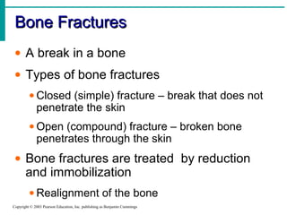 Bone FracturesBone Fractures
Copyright © 2003 Pearson Education, Inc. publishing as Benjamin Cummings
• A break in a bone
• Types of bone fractures
• Closed (simple) fracture – break that does not
penetrate the skin
• Open (compound) fracture – broken bone
penetrates through the skin
• Bone fractures are treated by reduction
and immobilization
• Realignment of the bone
 