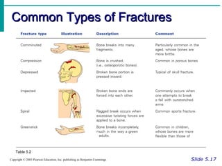 Common Types of FracturesCommon Types of Fractures
Slide 5.17Copyright © 2003 Pearson Education, Inc. publishing as Benjamin Cummings
Table 5.2
 