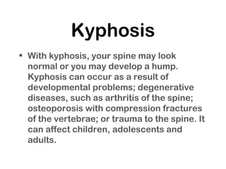 Kyphosis
• With kyphosis, your spine may look
normal or you may develop a hump.
Kyphosis can occur as a result of
developmental problems; degenerative
diseases, such as arthritis of the spine;
osteoporosis with compression fractures
of the vertebrae; or trauma to the spine. It
can affect children, adolescents and
adults.
 