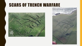 SCARS OF TRENCH WARFARE
 