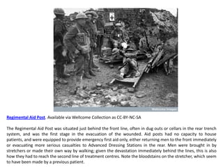 Regimental Aid Post. Available via Wellcome Collection as CC-BY-NC-SA

The Regimental Aid Post was situated just behind the front line, often in dug outs or cellars in the rear trench
system, and was the first stage in the evacuation of the wounded. Aid posts had no capacity to house
patients, and were equipped to provide emergency first aid only, either returning men to the front immediately
or evacuating more serious casualties to Advanced Dressing Stations in the rear. Men were brought in by
stretchers or made their own way by walking; given the devastation immediately behind the lines, this is also
how they had to reach the second line of treatment centres. Note the bloodstains on the stretcher, which seem
to have been made by a previous patient.
 