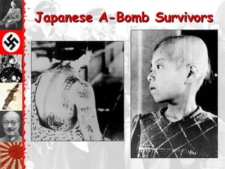 Japanese A-Bomb Survivors
 