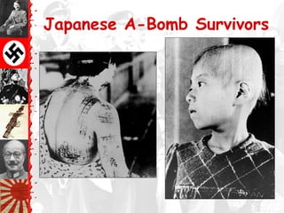 WW2