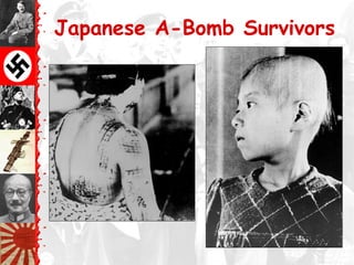 Japanese A-Bomb Survivors
 