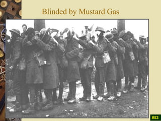 Blinded by Mustard Gas #53 
