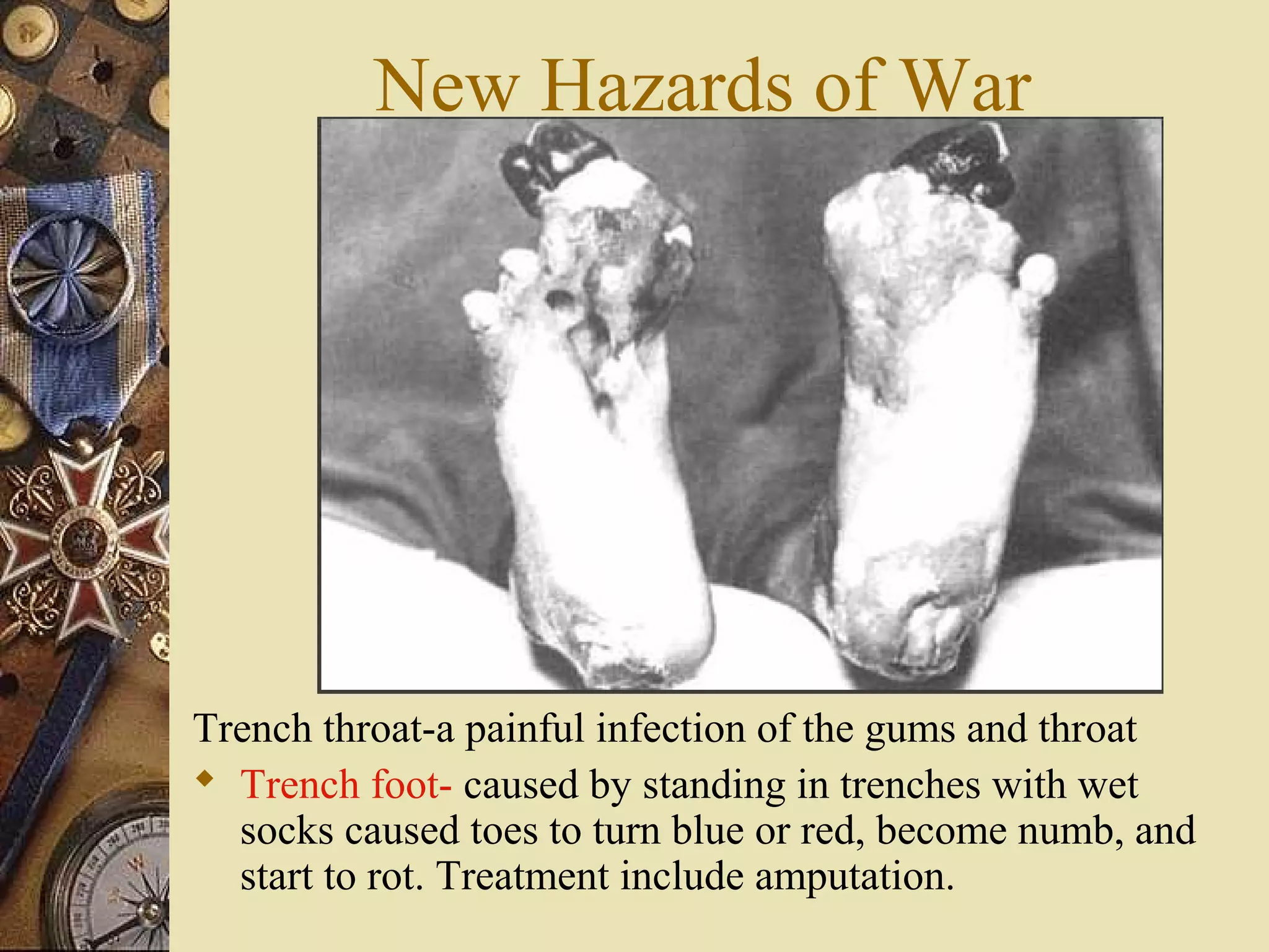 New Hazards of War




Trench throat-a painful infection of the gums and throat
 Trench foot- caused by standing in trenches with wet
  socks caused toes to turn blue or red, become numb, and
  start to rot. Treatment include amputation.
 