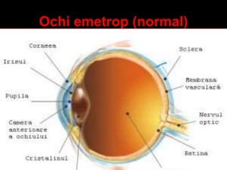 Ochi emetrop (normal) 
 