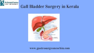 www.gastrosurgeoncochin.com
Gall Bladder Surgery in Kerala
 