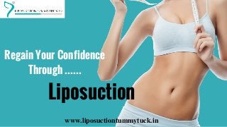 www.liposuctiontummytuck.in
Regain Your Confidence
Through ......
Liposuction
 