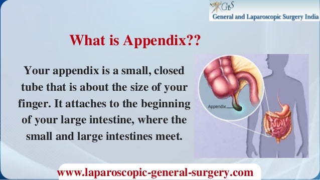 appendix removal surgery in bangalore laparoscopic appendicitis sur size of appendix