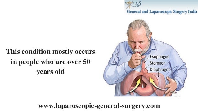 Hiatal Hernia Treatment In Bangalore | Laparoscopic Hernia Surgery In…