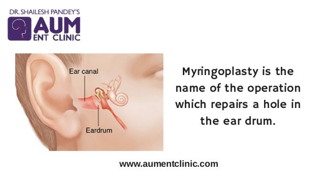 eardrum repair treatment in mumbai ent surgeon in india