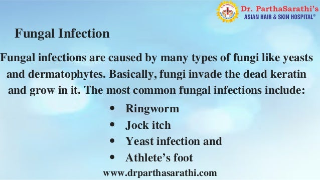 Yeast infection specialist
