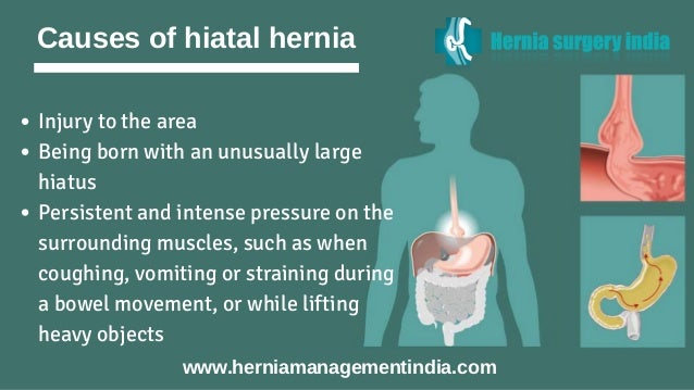 Laparoscopic Hiatal Hernia