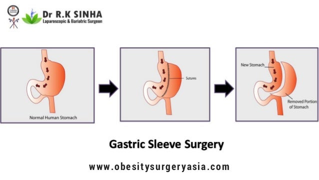 Medical weight loss ventura county image 5