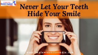 w w w . i m p l a n t d e n t i s t i n d i a . c o m
Never Let Your Teeth
Hide Your Smile
 