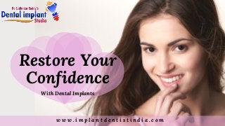 w w w . i m p l a n t d e n t i s t i n d i a . c o m
With Dental Implants
Restore Your
Confidence
 