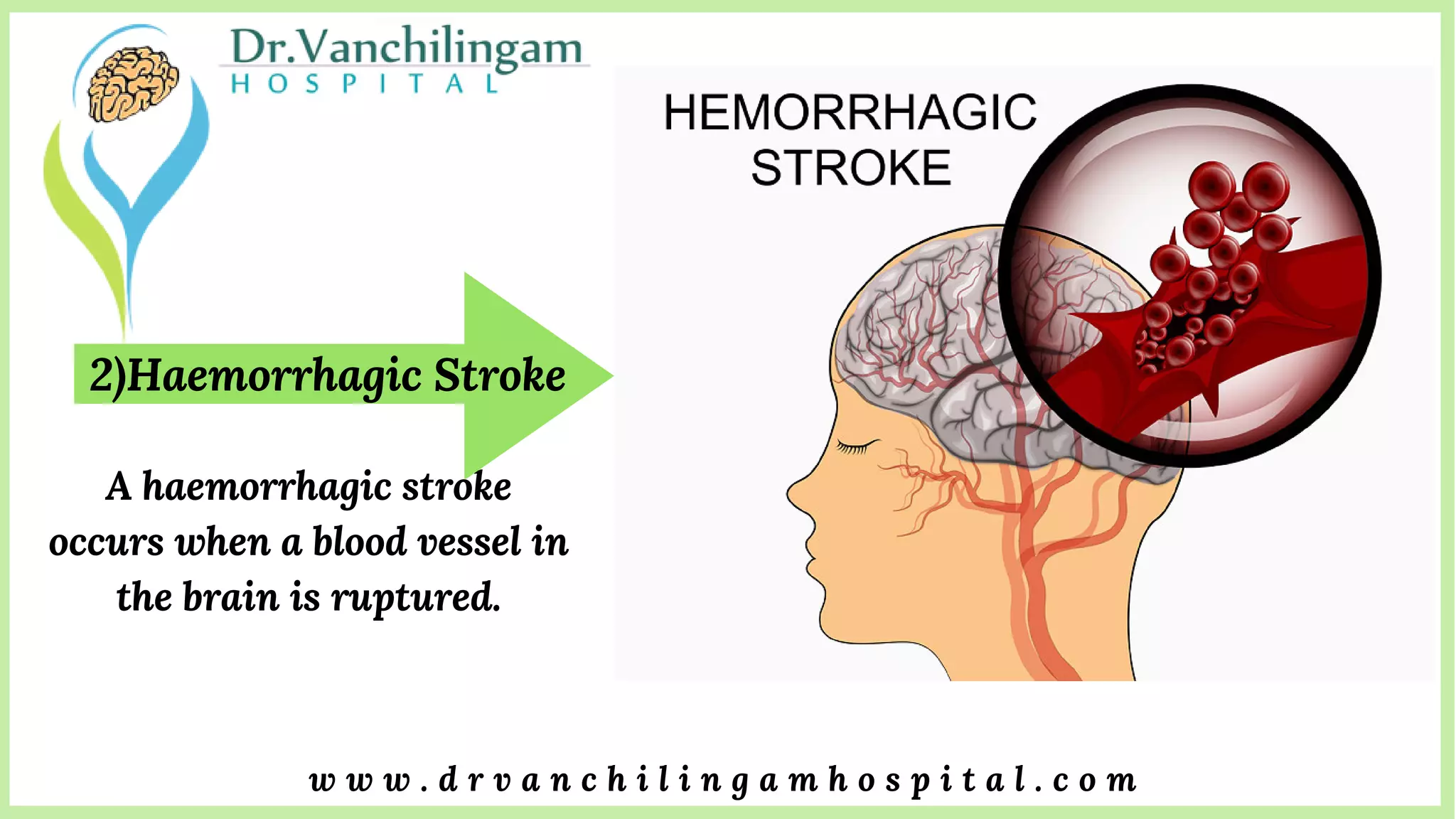 stroke-treatments-in-thanjavur-ischemic-stroke-brain-stroke