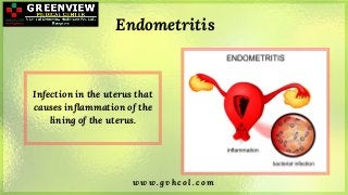 w w w . g v h c o l . c o m
Endometritis
Infection in the uterus that
causes inflammation of the
lining of the uterus.
 