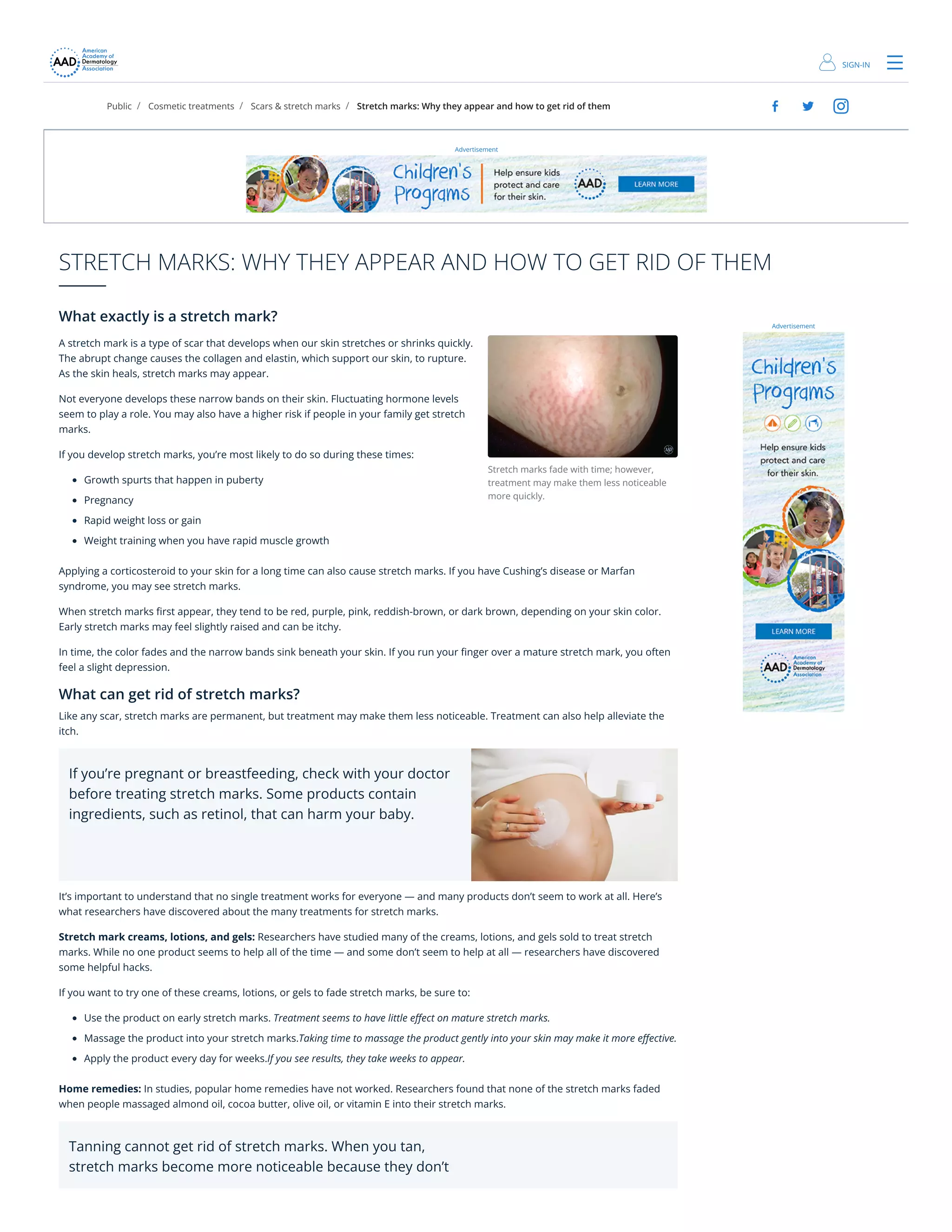 STRETCH MARKS: WHY THEY APPEAR AND HOW TO GET RID OF THEM | PDF