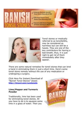 Tonsil stones or medically
                                  referred to as tonsilloliths,
                                  may be considered as
                                  harmless but can still be a
                                  hassle. They are one of the
                                  key contributors for having a
                                  bad breath, thus, it is just
                                  right to get rid of them
                                  immediately after they
                                  appear.


There are some natural remedies for tonsil stones that can lend
a hand in eliminating them in just a short time. Here’s some
tonsil stone remedy without the use of any medication or
undergoing a surgery.

Click Here For Instant Download of
“Banish Tonsil Stones” ebook:
http://tinyurl.com/curetonsils



Lime/Pepper and Turmeric
Powder

Traditionally, lime has been used
for eliminating tonsil stones. All
you have to do is to squeeze some
lime in a glass of water. Then you
 