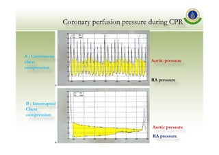 Guide line CPR 2010 (ไทย) | PDF