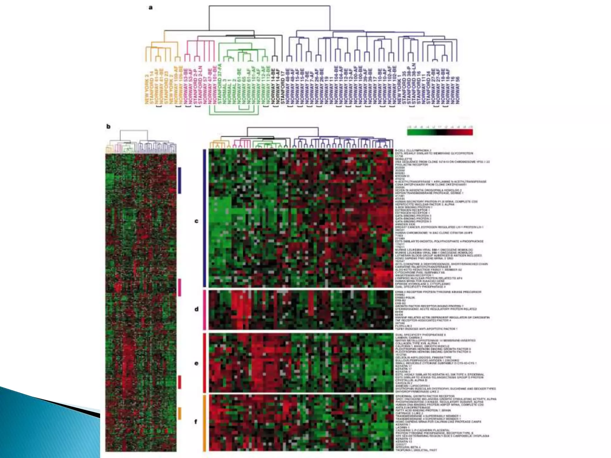 Molecular subtypes of breast cancer | PPTX