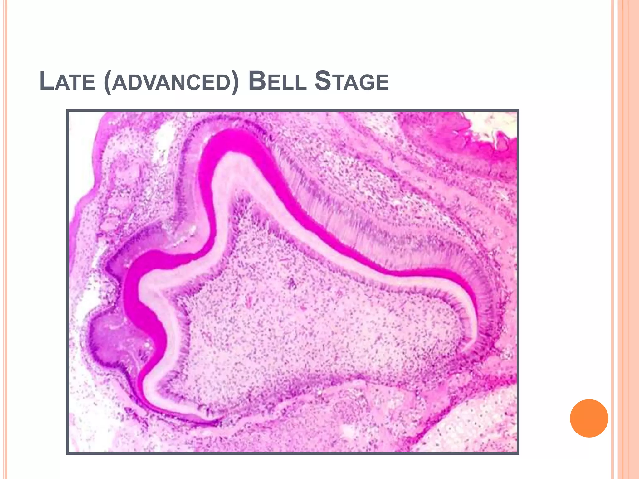 PERMANENT SUCCESSORS
DEVELOP FROM SUCCESSIONAL LAMINA ON
LINGUAL ASPECT OF THEIR PREDECESSOR TEETH